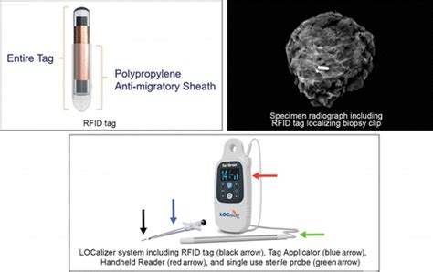 rfid tag to tag interference|rfid tagging in breast surgery.